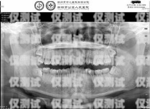 智齒，口腔中的小麻煩智齒機器人客服